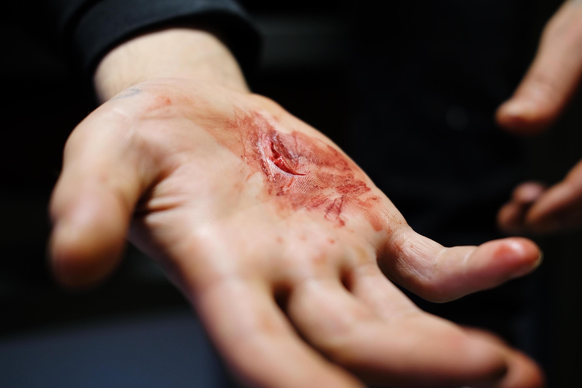 Main ensanglantée d’un détenu qui a été agressé en promenade